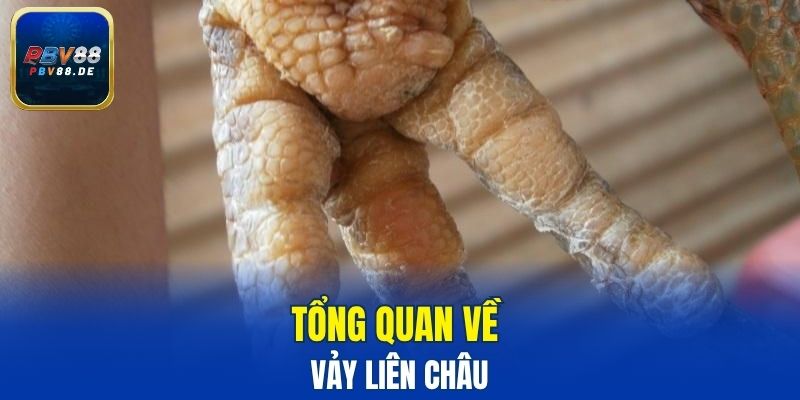 Tổng quan về vảy liên châu